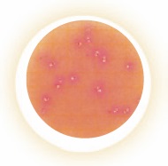 Petrifilm HSCC HS